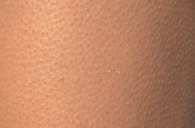  » Bekommst du Gänsehaut beim Musik hören?!